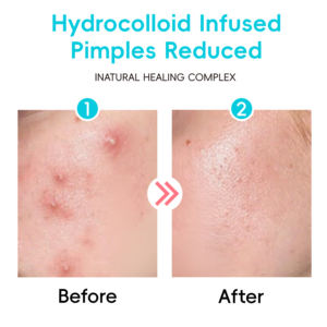 Dotdot personalizable Invisible hidrocoloide reparación nueva llegada arte Graffiti impreso mismo estilo de moda <span class=keywords><strong>mercado</strong></span> principal cúrcuma - Product Image 6