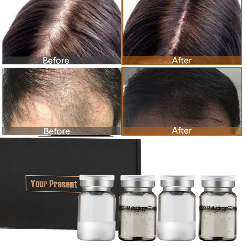 Hair Growth for Hair Growth Treatment