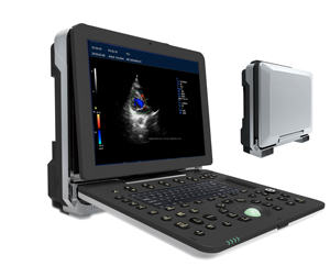 <span class=keywords><strong>Scanner</strong></span> à ultrasons Doppler couleur 4D 5D couleur pour usage médical - Product Image 2