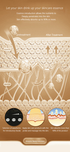 Nuevo Dispositivo de Tonificación Facial Ultrasónico 2026, Sistema de Cuidado de la Piel con Doble Sonda para Rejuvenecimiento, Estiramiento y Reafirmación Facial y Ocular - Product Image 5