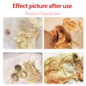 Píldoras de Desintoxicación Yoni Herbales Tradicionales OEM al por Mayor, Productos Naturales para la Higiene Íntima - Product Image 6