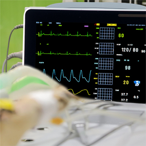 Medische Veterinaire <span class=keywords><strong>12</strong></span> Inch Oplaadbare Draagbare Vitale Functies Monitor Met Spo2 Temp Nibp Puls Oximetrie Multi-Parameter Monitor - Product Image 5