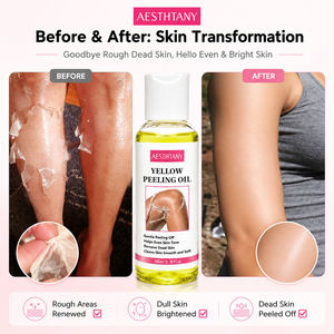 Huile exfoliante jaune peel-off personnalisable pour le corps, soin de la peau, éclaircissement et élimination des peaux mortes, cosmétique coréenne - Product Image 3