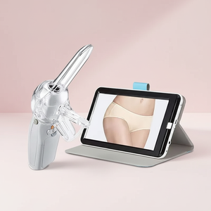 Colposcopio Digital HD Sunbright S-10U para Examen Ginecológico, Colposcopio Vaginal Portátil - Product Image 1