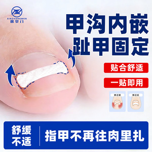 [Xin Zhangmen] Toenail Fixation and Care Patches 10 Patches/Box, Nail Groove Corrector, Orthognathic Patch, <b>Physical</b> Assistance - Product Image 2