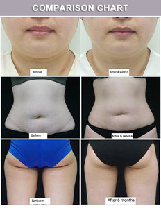 Professional <strong>Cryotherapy</strong> two Handle Device Portable <strong>Cryotherapy</strong> Machine <strong>Price</strong> Slimming Machine - Product Image 4