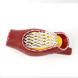 Modelo <span class=keywords><strong>de</strong></span> stent vascular <span class=keywords><strong>de</strong></span> ciencia médica modelo vascular humano enseñanza médica modelo <span class=keywords><strong>de</strong></span> <span class=keywords><strong>anatomía</strong></span> vascular <span class=keywords><strong>patológica</strong></span> - Product Image 5