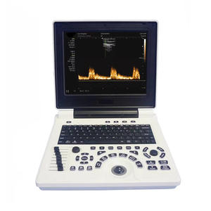 Máquina de Ultrasonido Veterinaria P20, Diagnóstico de Cuerpo Completo, Portátil, Sonda Convexa Lineal, Certificación CE, Uso Profesional en Clínicas Veterinarias - Product Image 1