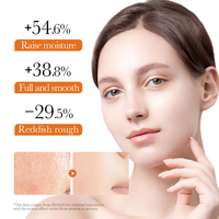 Vente en gros, crème pour le visage au curcuma, soin anti-acné contre les taches foncées, crème éclaircissante et blanchissante au curcuma pour peau foncée
