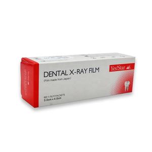 Pellicole Radiografiche Dentali Yes <span class=keywords><strong>Star</strong></span> di Alta Qualità per Uso in Camera Chiara - Product Image 3