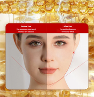 Appareil de beauté électrique à micro-courant doux pour le visage, outil de soin anti-âge et de sécurité pour la peau, raffermit la peau