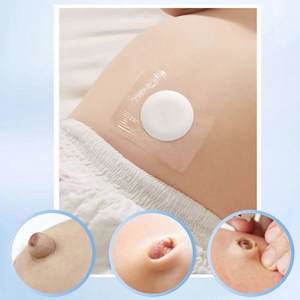 Parche para <span class=keywords><strong>Hernia</strong></span> Umbilical para Bebés, Material de Algodón, Alivia el Dolor, Amigable con la Piel, Transpirable, Cómodo, 8*8cm, Uso Hospitalario - Product Image 6