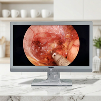 Système d'imagerie 4K avancé TU-402 pour usage hospitalier, images haute résolution, procédures chirurgicales précises, interventions mini-invasives