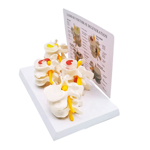 Tussenwervelschijf Degeneratie Osteoporose Model Lumbale Hernia Model Normale Plastic Lumbale Wervelkolom Model - Product Image 4