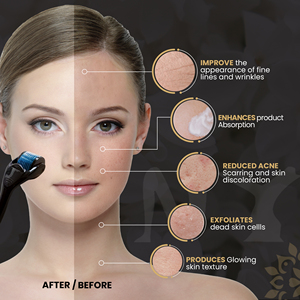 Terapia de inducción de colágeno personalizada Skin Glowing Microneedle Derma Roller 540 agujas para uso doméstico - Product Image 2