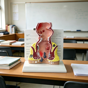 Modello Anatomico di Emorroidi Anorettali Umane con Malattie Rettali Comuni per l'Insegnamento in Gastroenterologia - Product Image 4