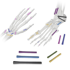 Tornillos de Compresión Canulados Sin Cabeza de Titanio CANWELL, Sistema de Implantes Ortopédicos para Trauma, Certificado CE - Product Image 4