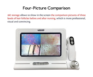 Analizador de Cuero Cabelludo y Cabello con Doble Sonda 50X 200X, Detector de Folículos Pilosos, Máquina Analizadora de Cuero Cabelludo - Product Image 3