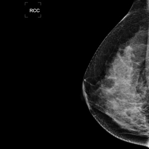 Système de mammographie numérique INM-5KW, appareil de mammographie à rayons X, tube à rayons X pour mammographie d'origine italienne IAE - Product Image 6