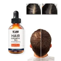 Sérum huile de croissance de cheveux 100% ml, formule à base de plantes, traitement pour la perte de cheveux
