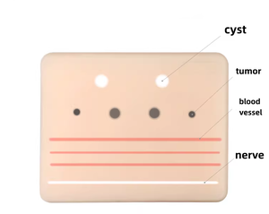 Nuevo Maniquí de Ultrasonido para Punción, Modelo de Entrenamiento Integral para Tumor Vascular y Quisto Nervioso - Product Image 4