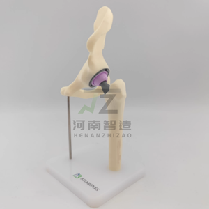 מודל החלפת מפרק ירך, מודל רופא מנתח רפואי של רופא-חולה, מיני גירסה - Product Image 4