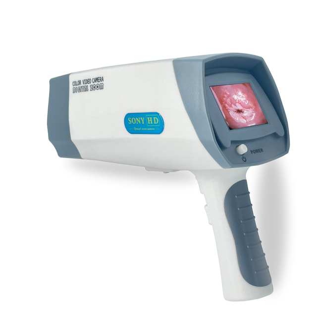 Factory Wholesale CE Medical Endoscope Video Colposcope for Vagina Portable Gynaecology Electronic Digital Colposcope