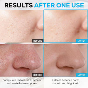 Limpiador Facial Coreano OEM, Control de Grasa, Lavado Facial para Mujeres, Espuma de Aminoácidos - Product Image 2