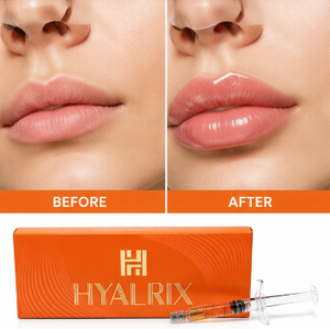 Hyalrix Vernetzte 24mg/ml Korea Dermalfiller Hyaluronsäure Dermalfiller Injizierbarer Filler zur Lippenvergrößerung - Product Image 1