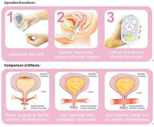 Beckenboden muskel trainer Biofeedback Kegel Exerciser CE-Zulassung - Product Image 6