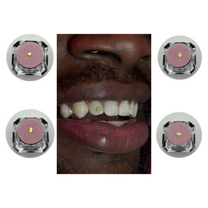 Gemas Dentales de Oro con Formas Novedosas al por Mayor, Joyería Dental Personalizada, Gemas de Aleación <span class=keywords><strong>para</strong></span> Decoración Dental - Product Image 3