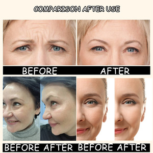 Venta al por mayor de ingredientes suaves adecuados para todo tipo de piel más brillante para conseguir un suero tensor facial - Product Image 4