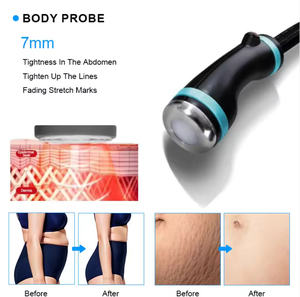 Appareil de massage Coolwaves à 3 poignées, 2,45 GHz, radiofréquence froide, pour la réduction de la graisse, la perte de poids, la cryolipolyse et le remodelage corporel amincissant - Product Image 3