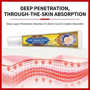 Baume Essentiel Apaisant Contre les Démangeaisons, Crème-Pommade Anti-Démangeaisons à Base de Plantes, OEM 20g <span class=keywords><strong>pour</strong></span> Irritations Cutanées et Piqûres d'Insectes, Dermatite, Eczéma, Herpès Fongique - Product Image 4
