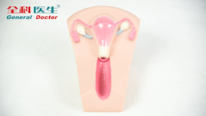 Modelo de Entrenamiento Médico Femenino GD/F5N para Dispositivos Intrauterinos Anticonceptivos, Material de PVC Avanzado, Certificado ISO 9001 - Product Image 2