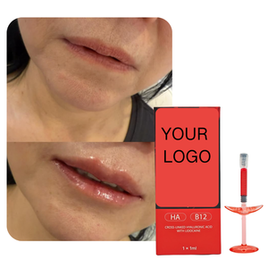 Filler Labbra Rosso da 1ml con Vitamina B12 e <span class=keywords><strong>Acido</strong></span> <span class=keywords><strong>Ialuronico</strong></span> per Labbra Naturalmente Morbide, Voluminose e Luminose - Product Image 2