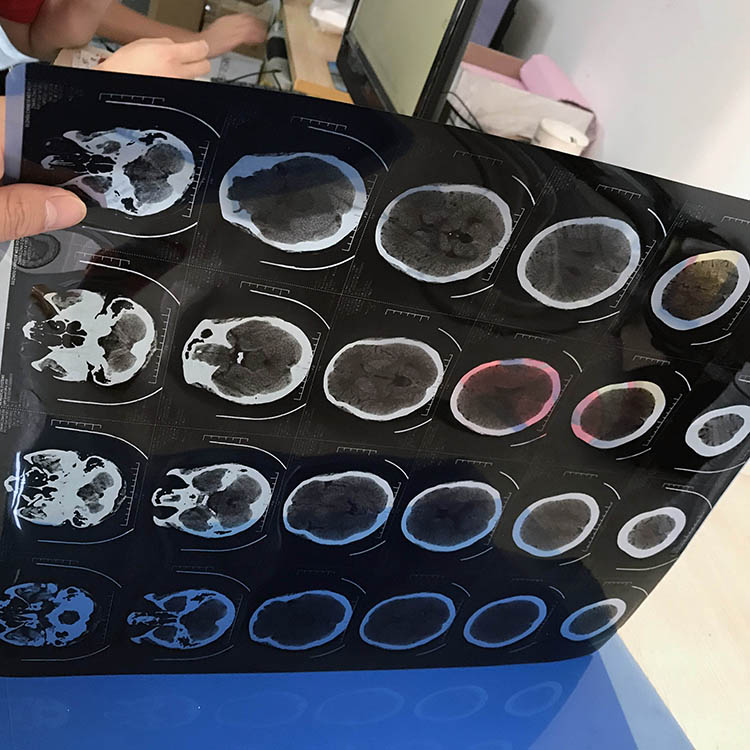 Procesador de película de rayos X automático digital médico Impresora de rayos X procesador de película radiográfica
