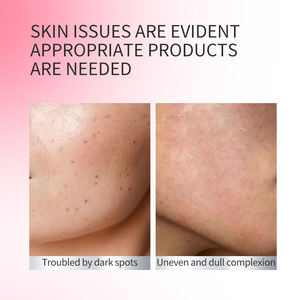 Suero Líquido Herbal con Vitamina C y E, Niacinamida Orgánica, Antienvejecimiento, Blanqueador e Hidratante para el Cuidado Facial de la Mujer, Marca Privada, en Stock - Product Image 5