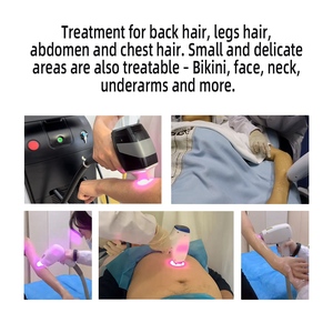Nouvel appareil d'épilation au <span class=keywords><strong>laser</strong></span> diode portable 808 nm pour femmes, équipement de spa médical, vente en gros - Product Image 5