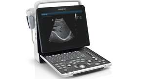 Mesin USG Mindray DP-50 Expert High Resistance Portable Multi Image untuk Hewan dan Manusia - Product Image 3