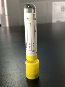 1ml 10 ml sarı üstü laboratuvar plastik pet cam serum ayırıcı jel vakum kan tüpleri laboratuvar için - Product Image 5