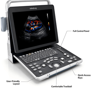 Máquina de Imágenes Veterinaria Mindray Z70 con 1 TB de Almacenamiento e Interfaz de Usuario Multilingüe, Equipo Veterinario - Product Image 4