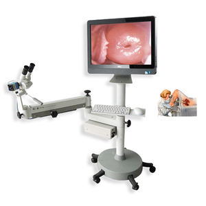 Kernel Binocular <span class=keywords><strong>Colposcopia</strong></span> para <span class=keywords><strong>Obstetricia</strong></span> Ginecología Control de la natalidad - Product Image 5