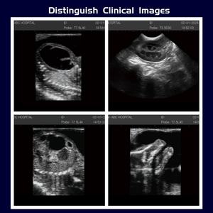 Appareil d'échographie portable 3D à double sonde haute définition pour la détection de la grossesse et des maladies chez l'homme et les animaux - Product Image 4
