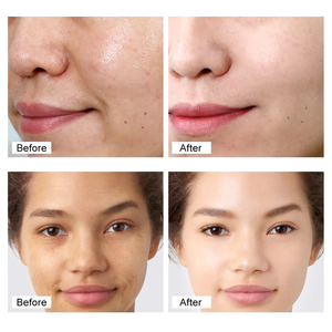 Custom OEM Brightening Skin Care <b>Serum</b> & Cream Set with AHA Hyaluronic Acid & Herbal <b>for</b> <b>Face</b> Dark Spot Reduction & Anti-Wrinkle - Product Image 6