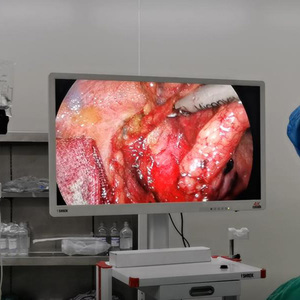 Moniteur de qualité médicale <span class=keywords><strong>55</strong></span> <span class=keywords><strong>pouces</strong></span> grand moniteur d'endoscope <span class=keywords><strong>pc</strong></span> pour laparoscope - Product Image 6