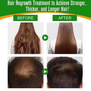 Máscara de crecimiento de cabello personalizada de etiqueta privada mantequilla ACEITE DE Batana para la naturaleza orgánica pura una reparación nutritiva Anti pérdida de cabello mantequilla para el cabello - Product Image 6