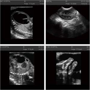 Scanner portatif complet numérique dp10 à ultrasons LED Machine à ultrasons d'application clinique Ruisheng N50 - Product Image 3