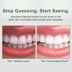 OEM Set Keluarga 5 Warna Cermin Mulut LED Alat Inspeksi Mulut Anti Kabut untuk Kebersihan Rumah - Product Image 3