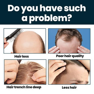 Solución para el Crecimiento del Cabello, Efecto Significativo Después del Uso, Despierta los Folículos Capilares Dormidos, Tratamiento para el Crecimiento del Cabello, Éxito en Ventas en Tiktok - Product Image 2